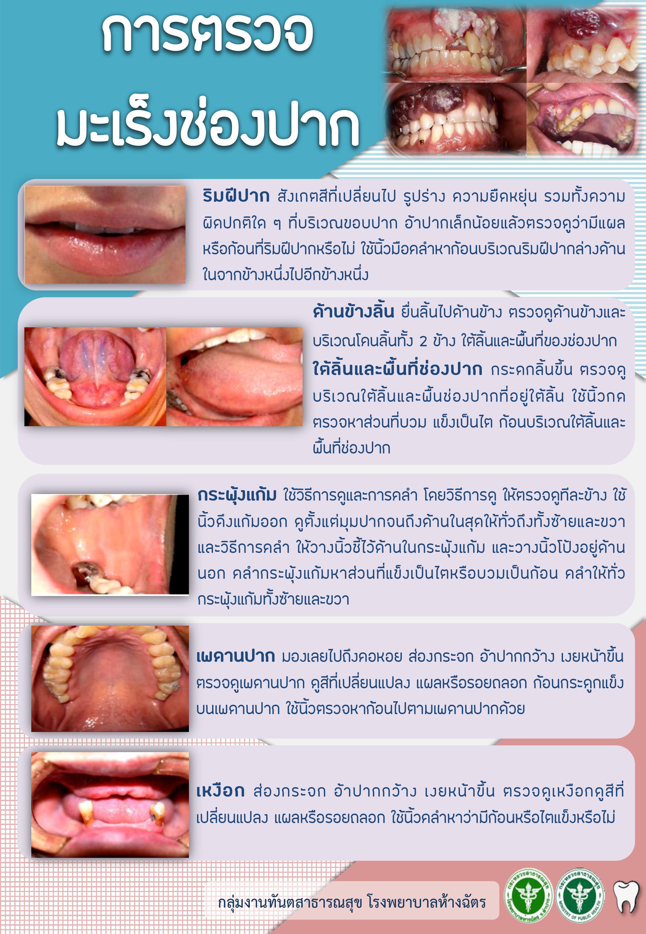 การตรวจมะเร็ง.jpg